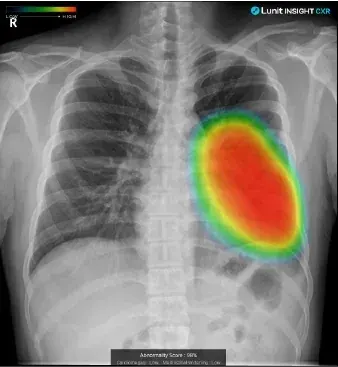 AI-Displayed Image 1