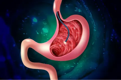 Diagram of the upper endoscopy route extending from the esophagus to the stomach and duodenum