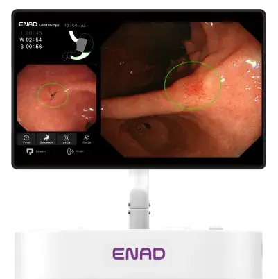 AI-Displayed Upper GI Endoscopy