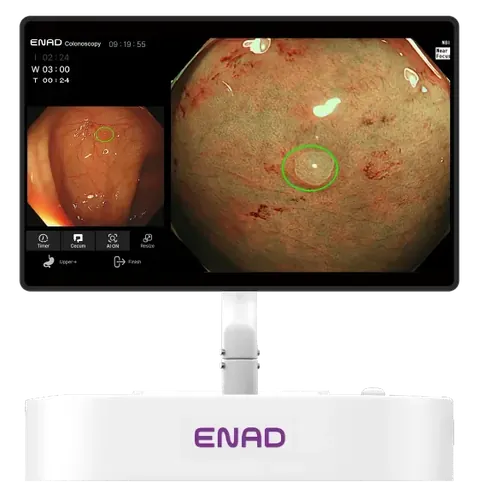 AI-Displayed Colonoscopy